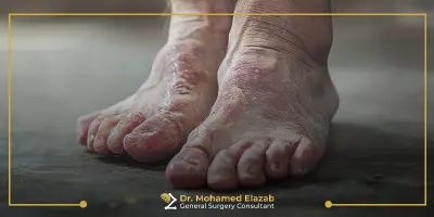 علاج الام القدمين لمرضى السكري