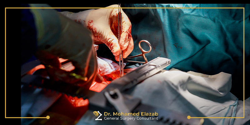 افضل دكتور جراحة عامة في مدينة نصر
