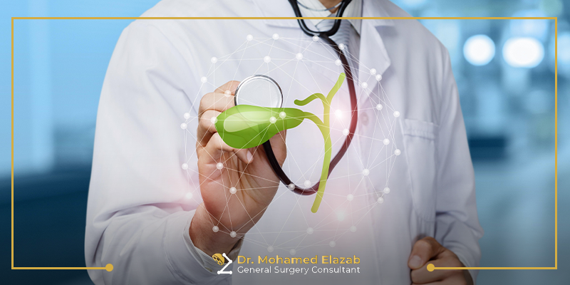 افضل طرق علاج المرارة