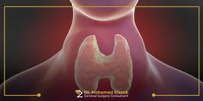 تضخم الغدة الدرقية