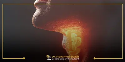 سرطان الغدة الدرقية