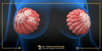 أعراض أكياس الثدي الحميدة