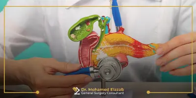 استئصال المرارة بالجراحة المفتوحة