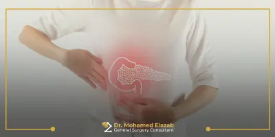 علاج التهاب المرارة الحاد